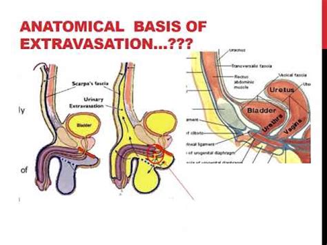 what is the gooch on the human body|Perineum: Location, Anatomy, Function & Conditions